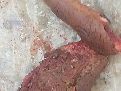Man Brutally Slashed By Machete (Photos)