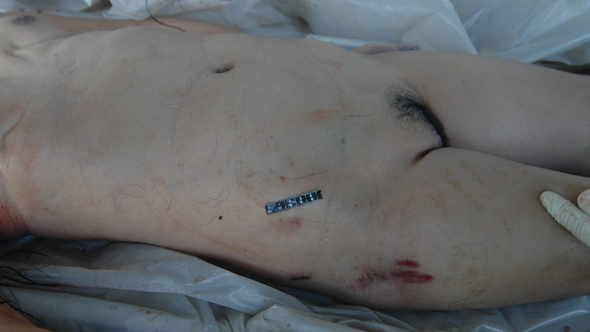 Brutally murdered Chinese woman - Autopsy