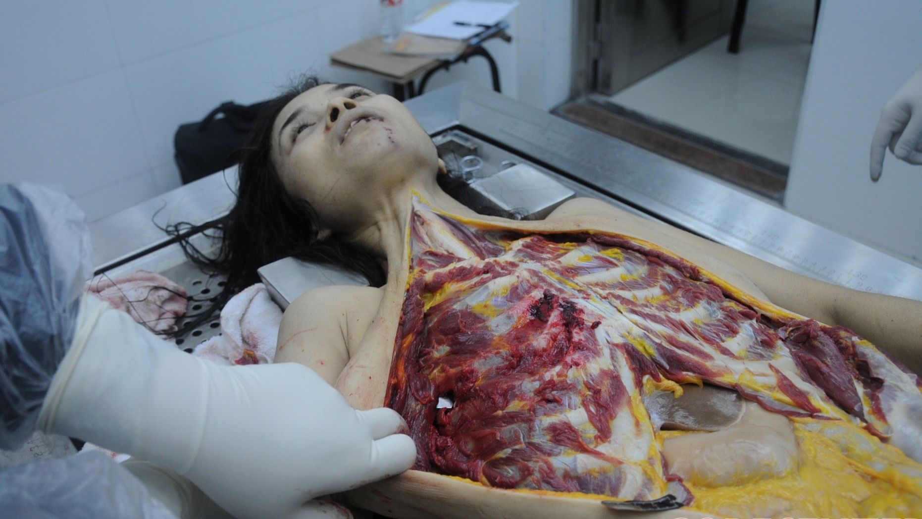 Detailed dissection of stabbed Chinese woman