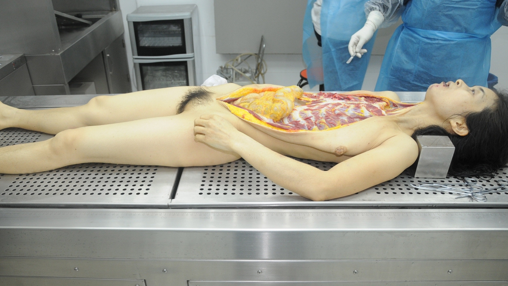 Detailed dissection of stabbed Chinese woman