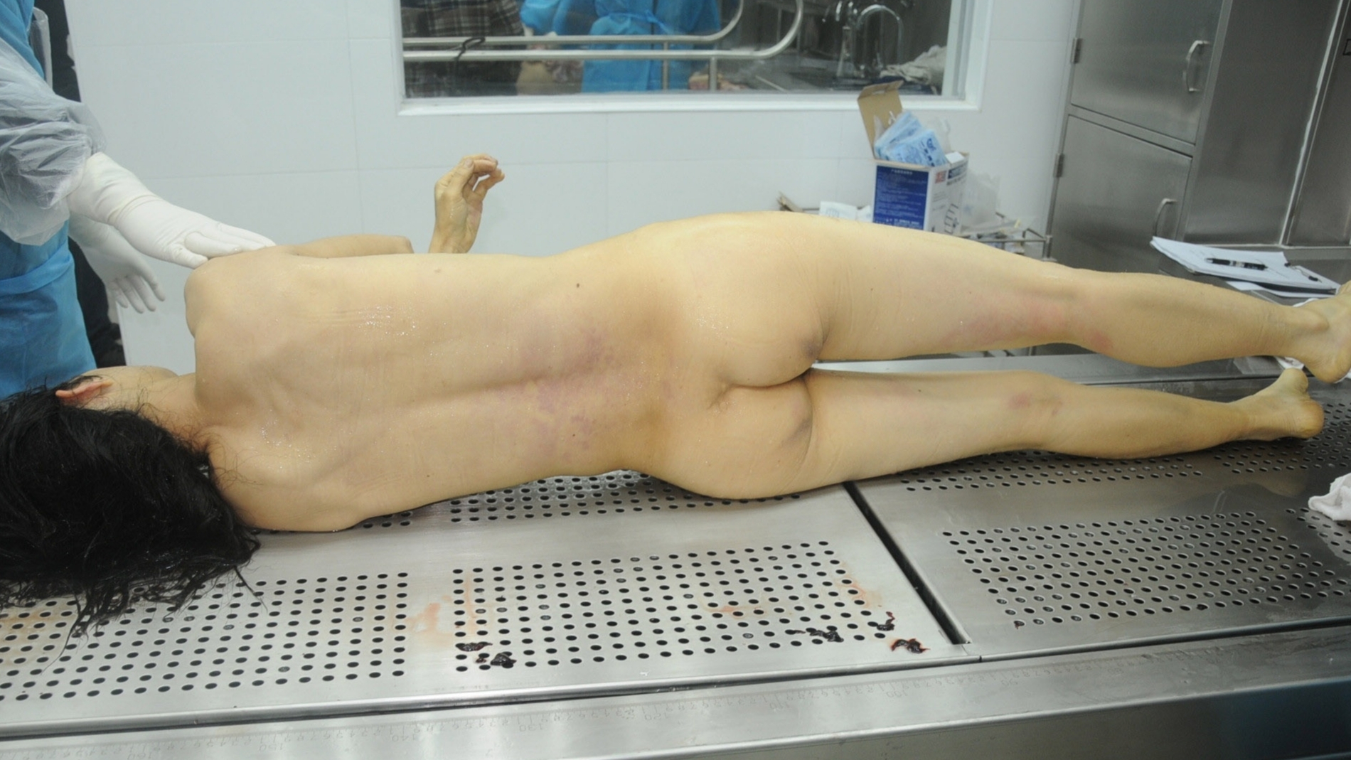 Detailed dissection of stabbed Chinese woman