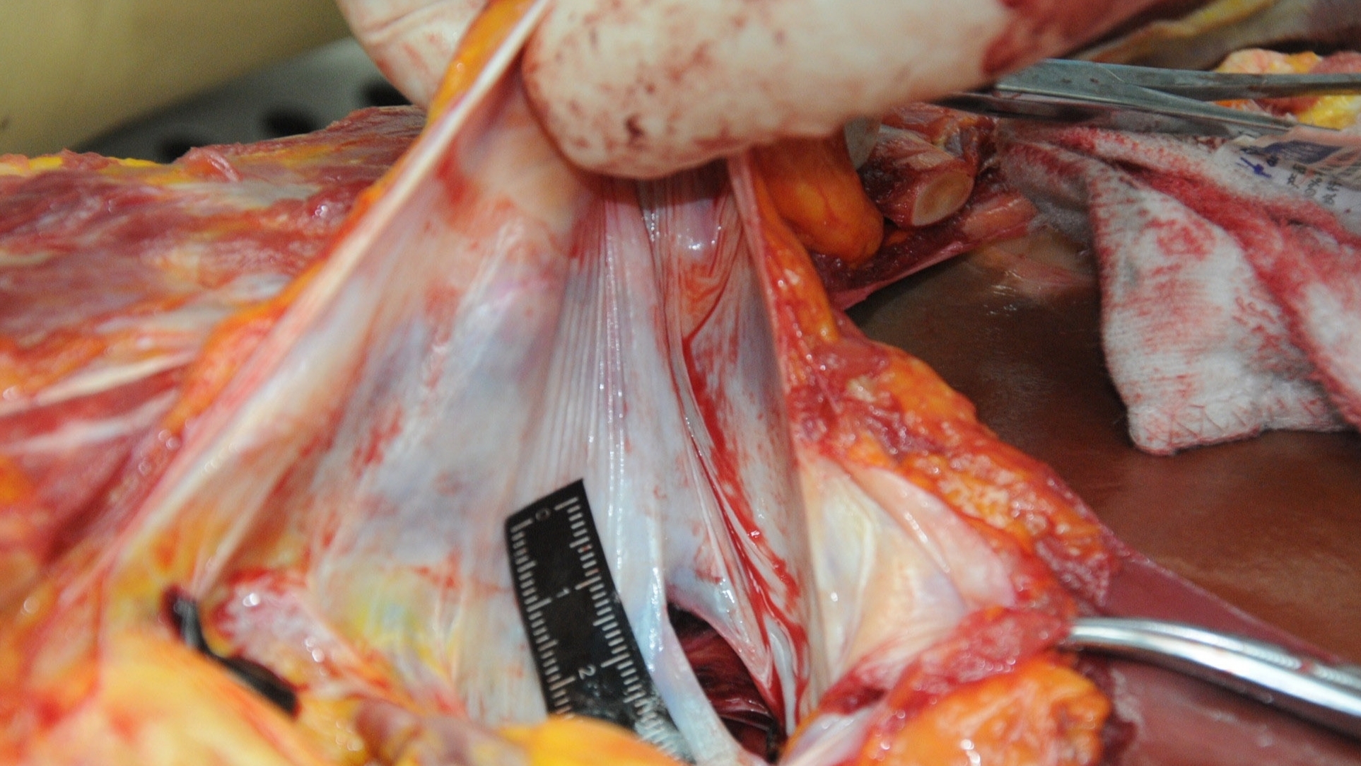 Detailed dissection of stabbed Chinese woman