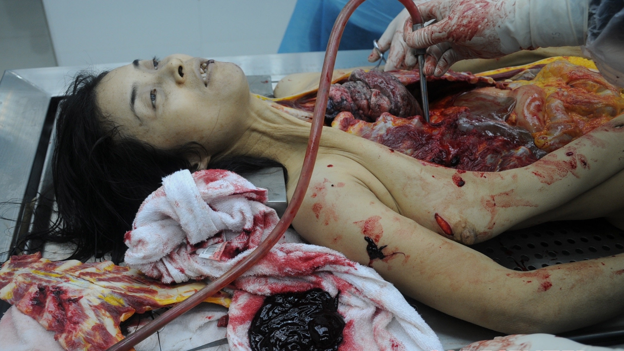 Detailed dissection of stabbed Chinese woman