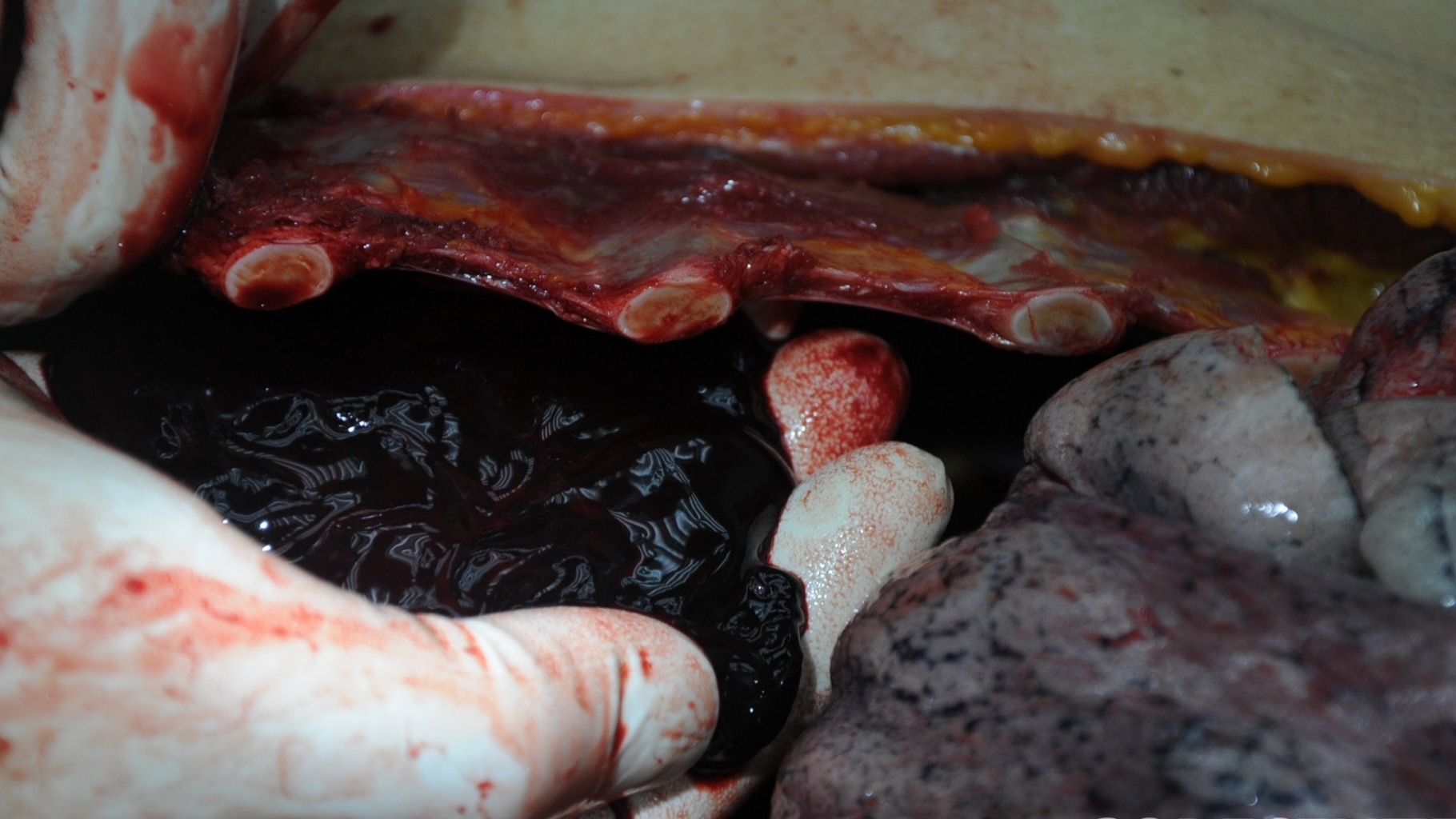 Detailed dissection of stabbed Chinese woman