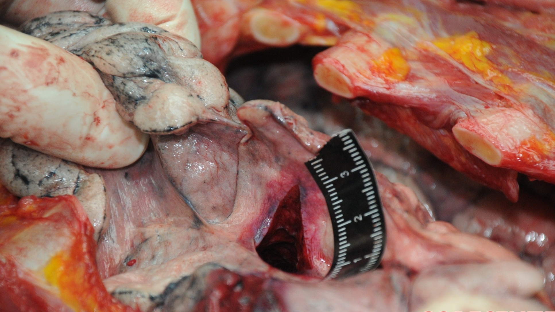 Detailed dissection of stabbed Chinese woman