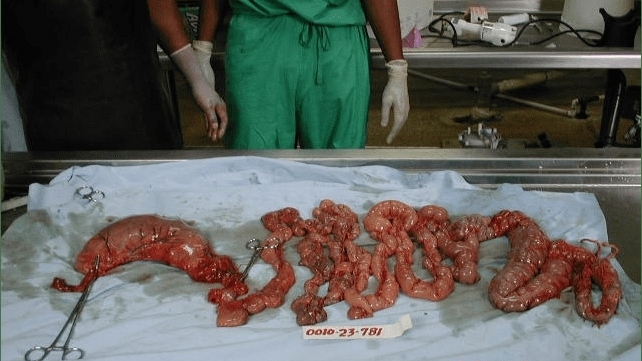 Autopsy of a drug mule