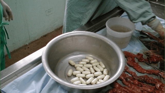 Autopsy of a drug mule