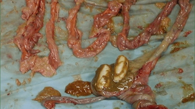 Autopsy of a drug mule