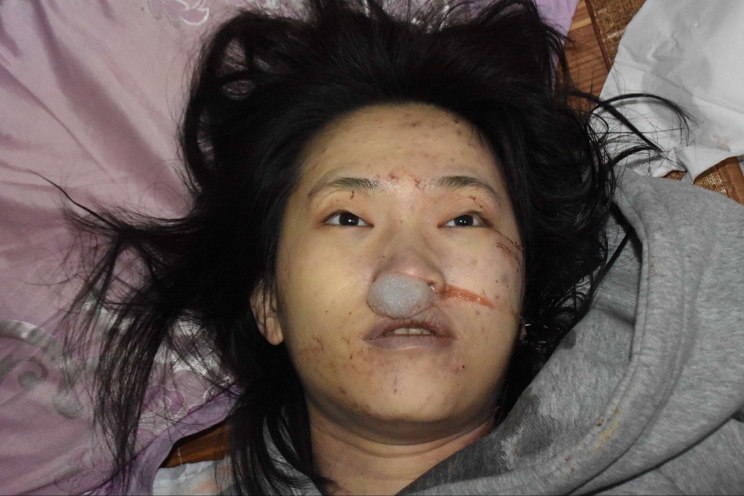 Chinese Women in Morgue