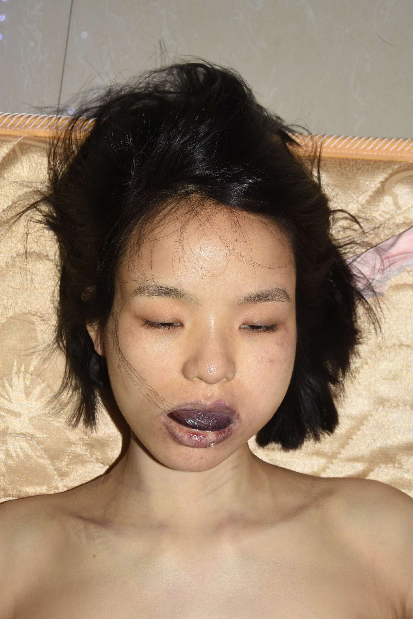 Chinese Women in Morgue
