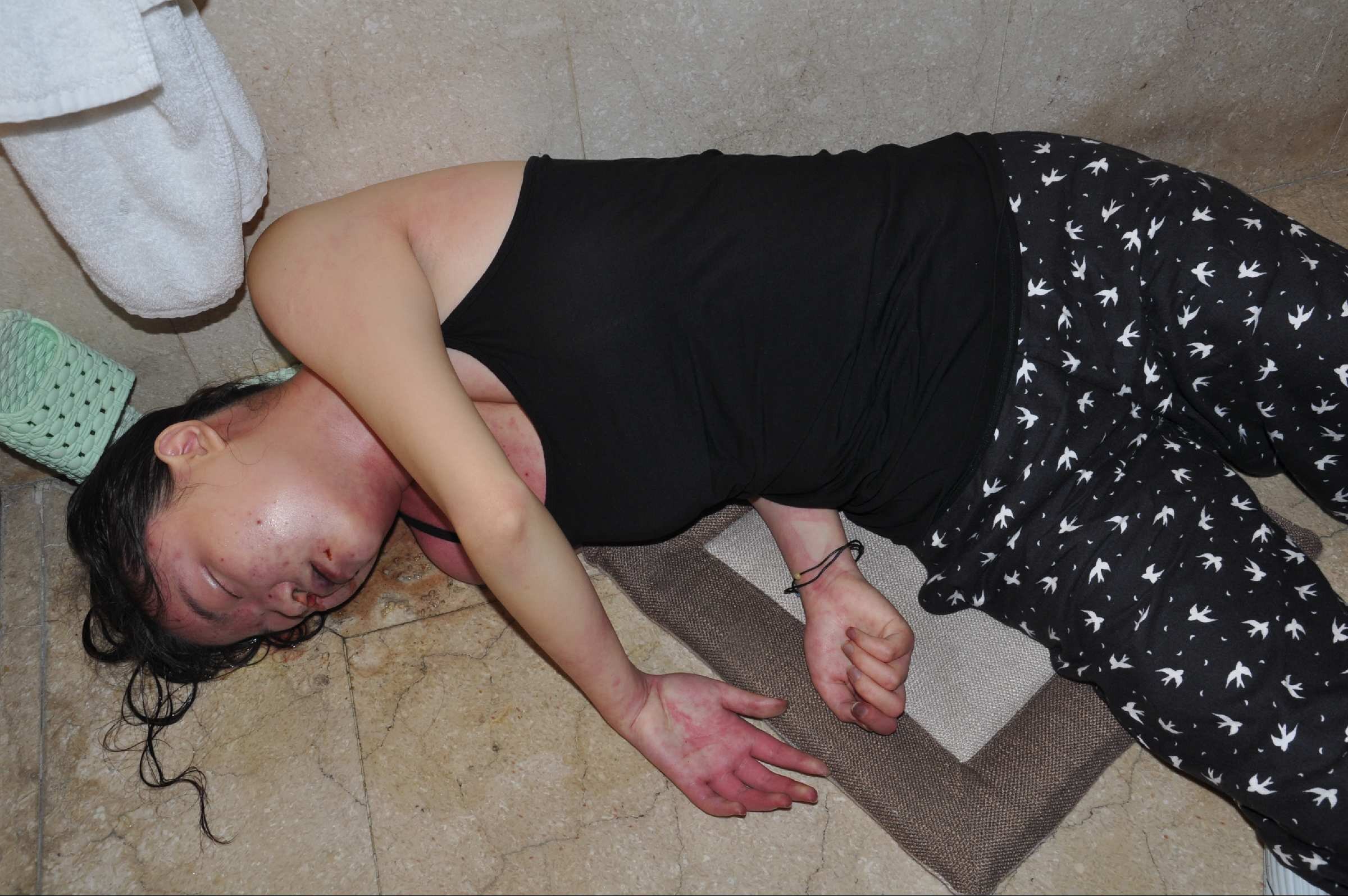 Chinese Women in Morgue