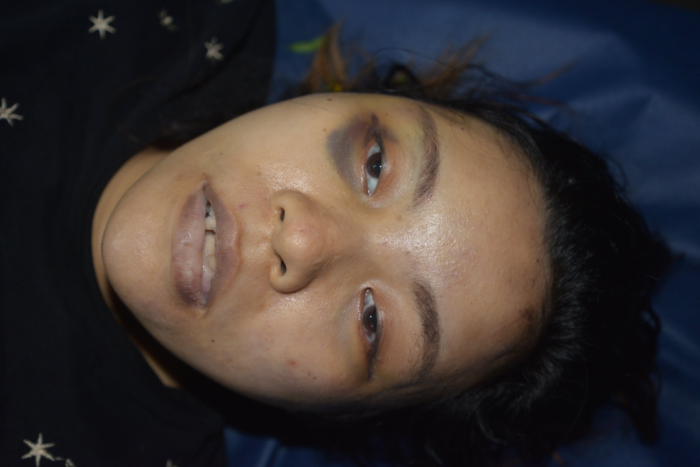 Chinese Women in Morgue