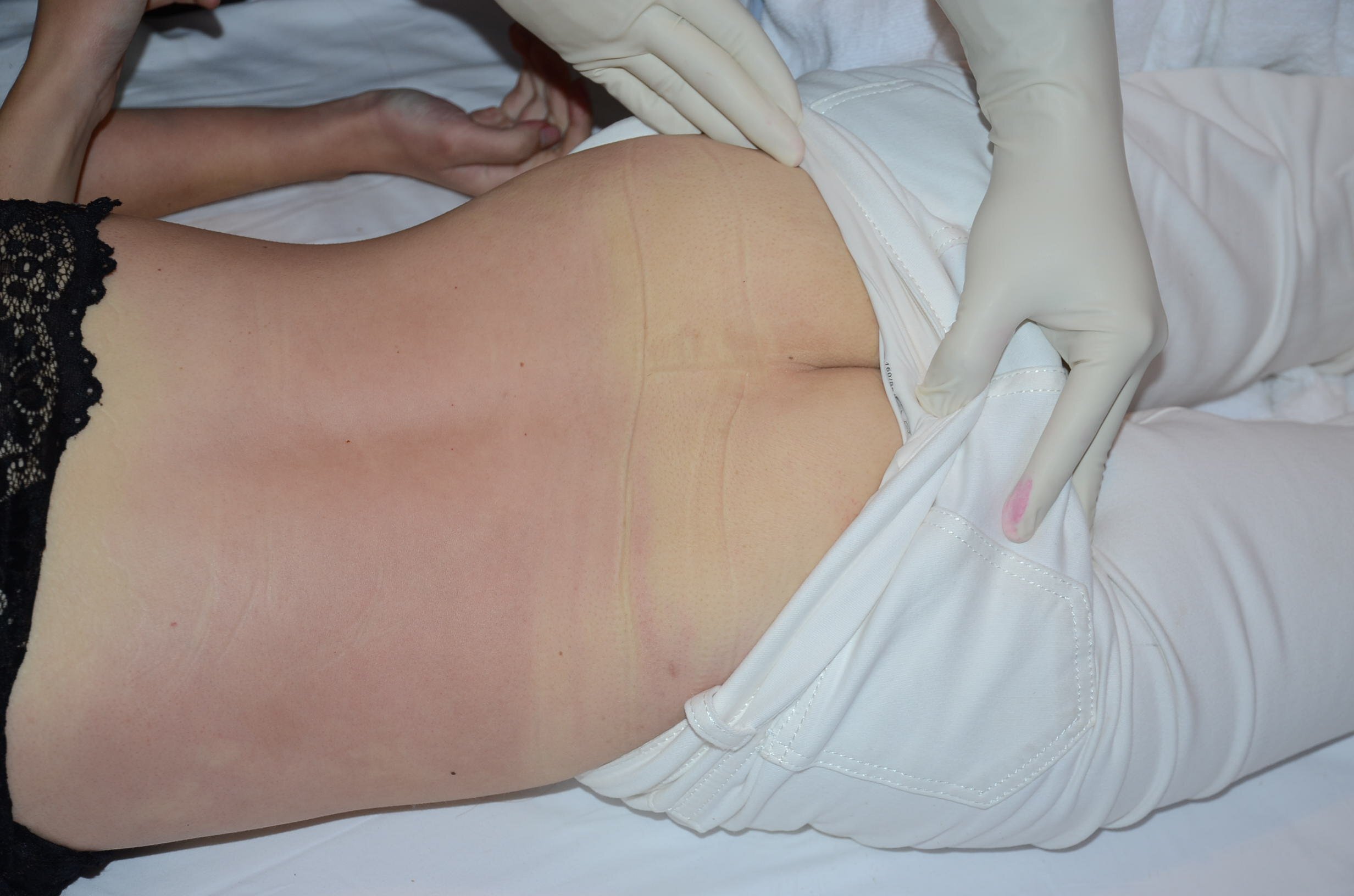 Beautiful Chinese Woman's Poison Suicide