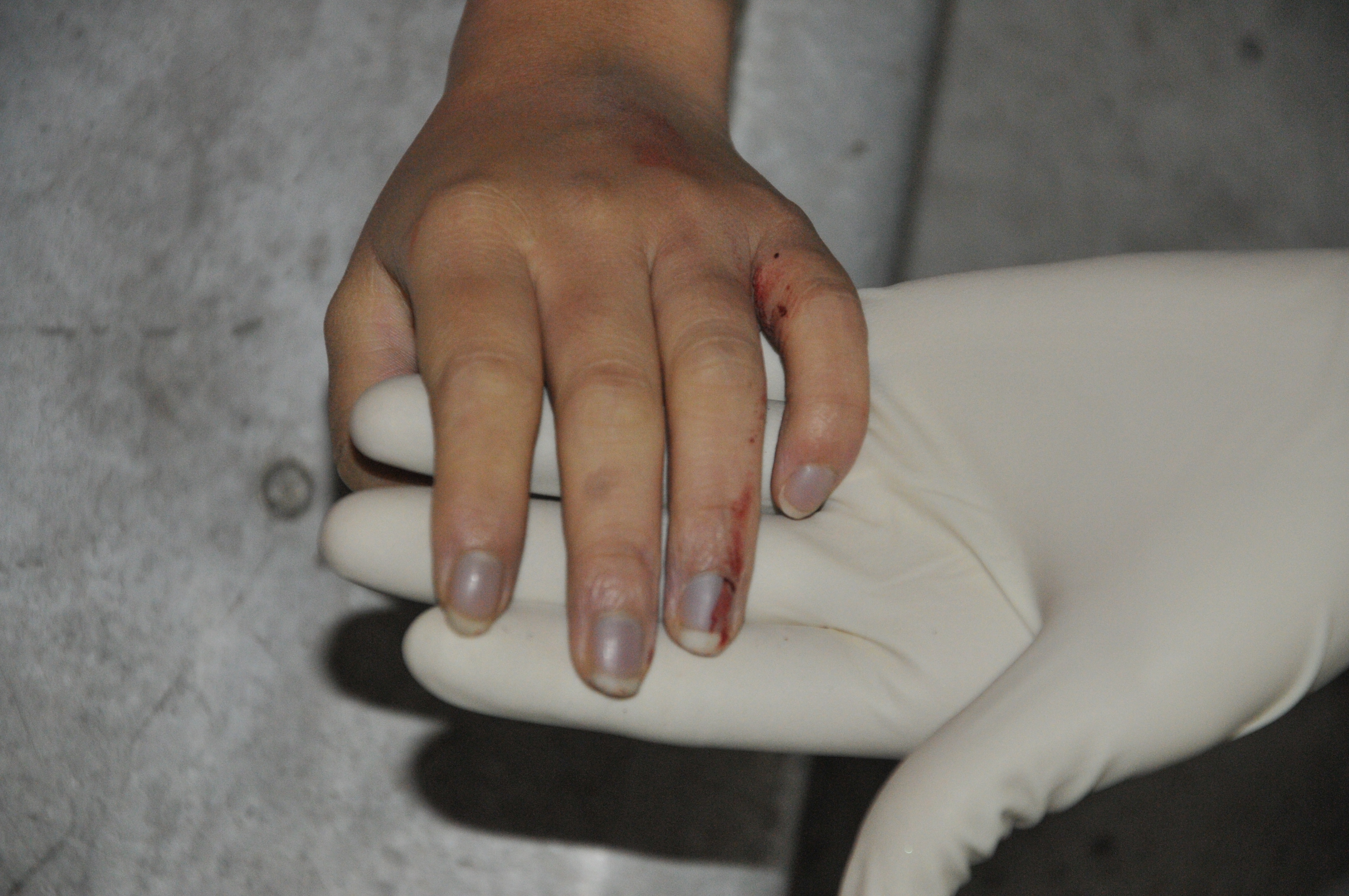 Pretty Woman's Suicide... Sad