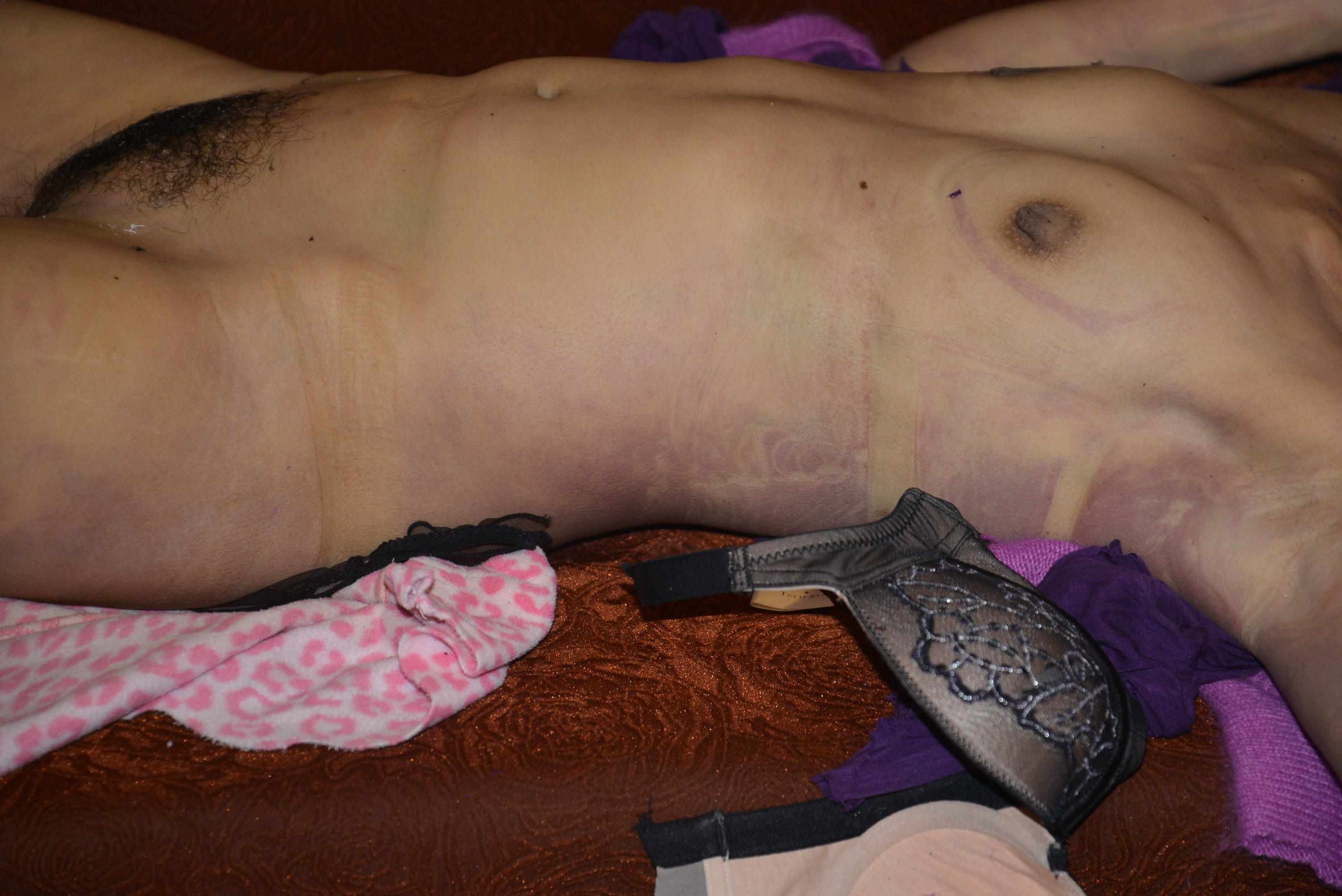 Dead Chinese women prostitute