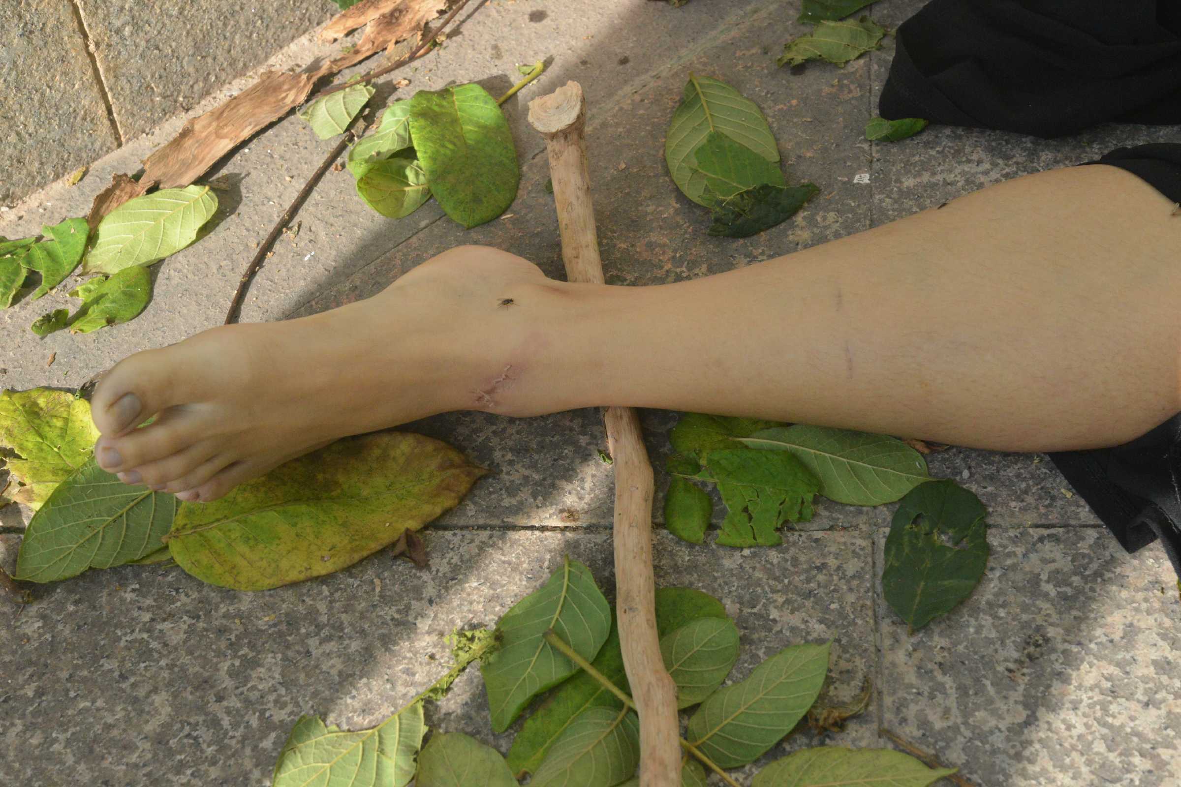 Poor Chinese Woman Murdered.