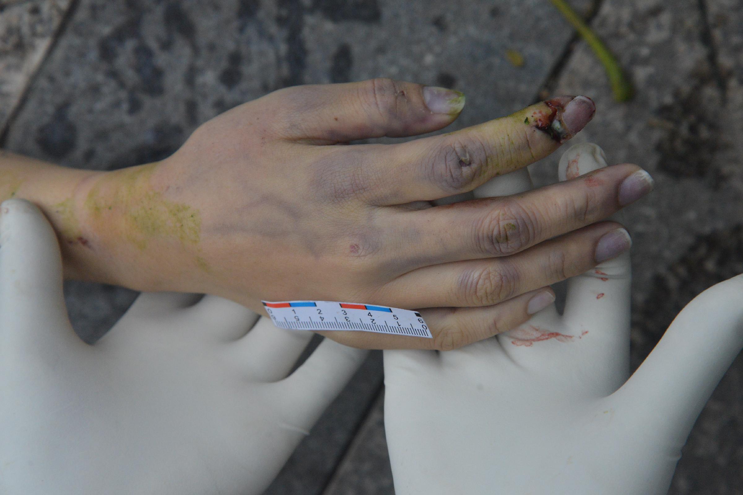 Poor Chinese Woman Murdered.