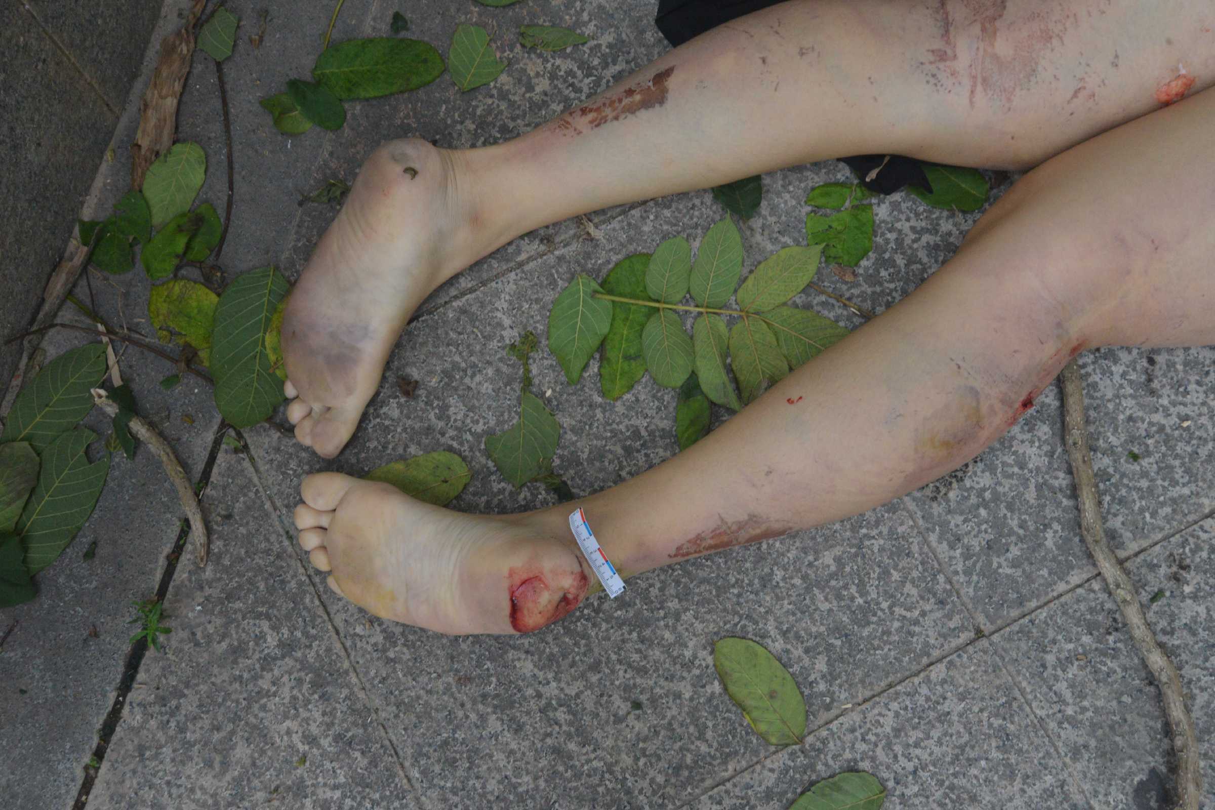 Poor Chinese Woman Murdered.