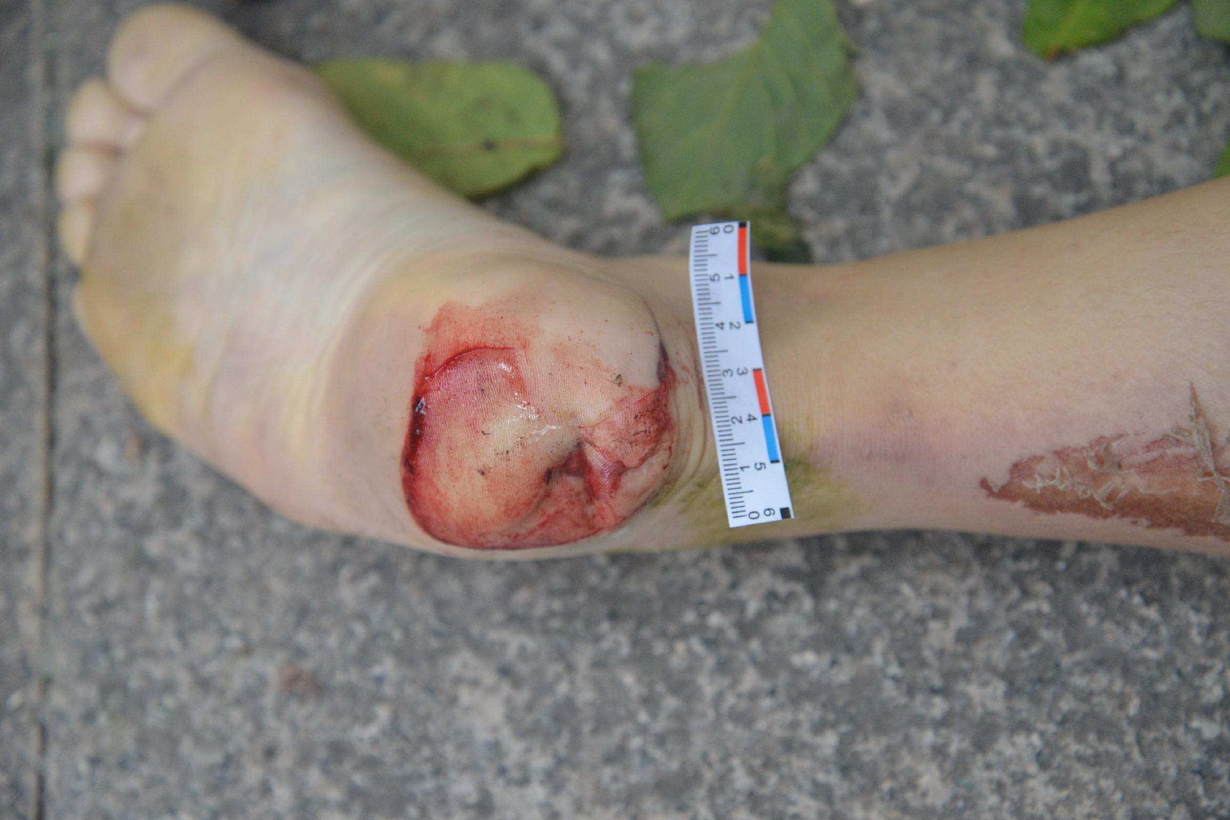 Poor Chinese Woman Murdered.