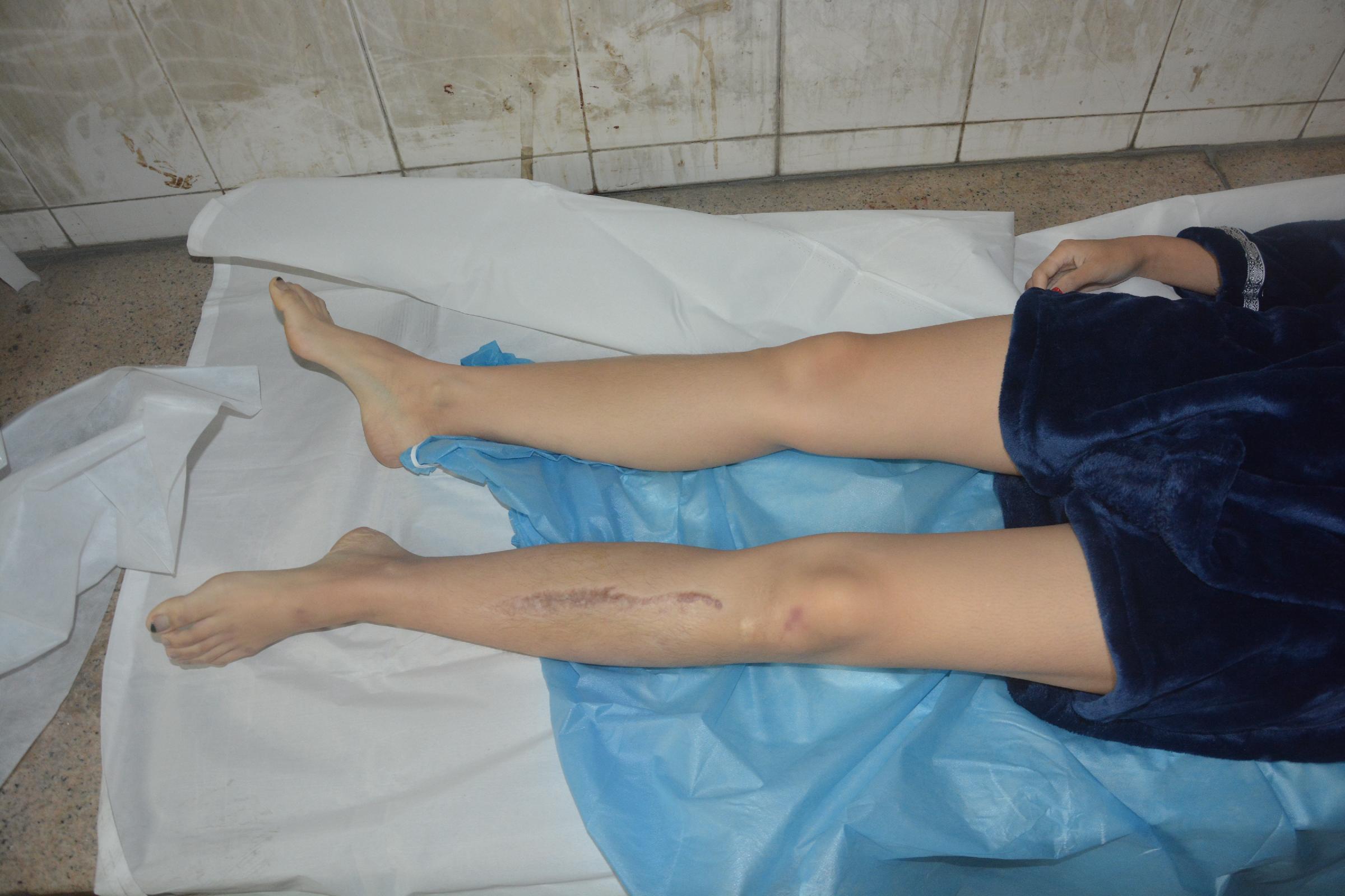 Pretty Chinese girl naked in morgue