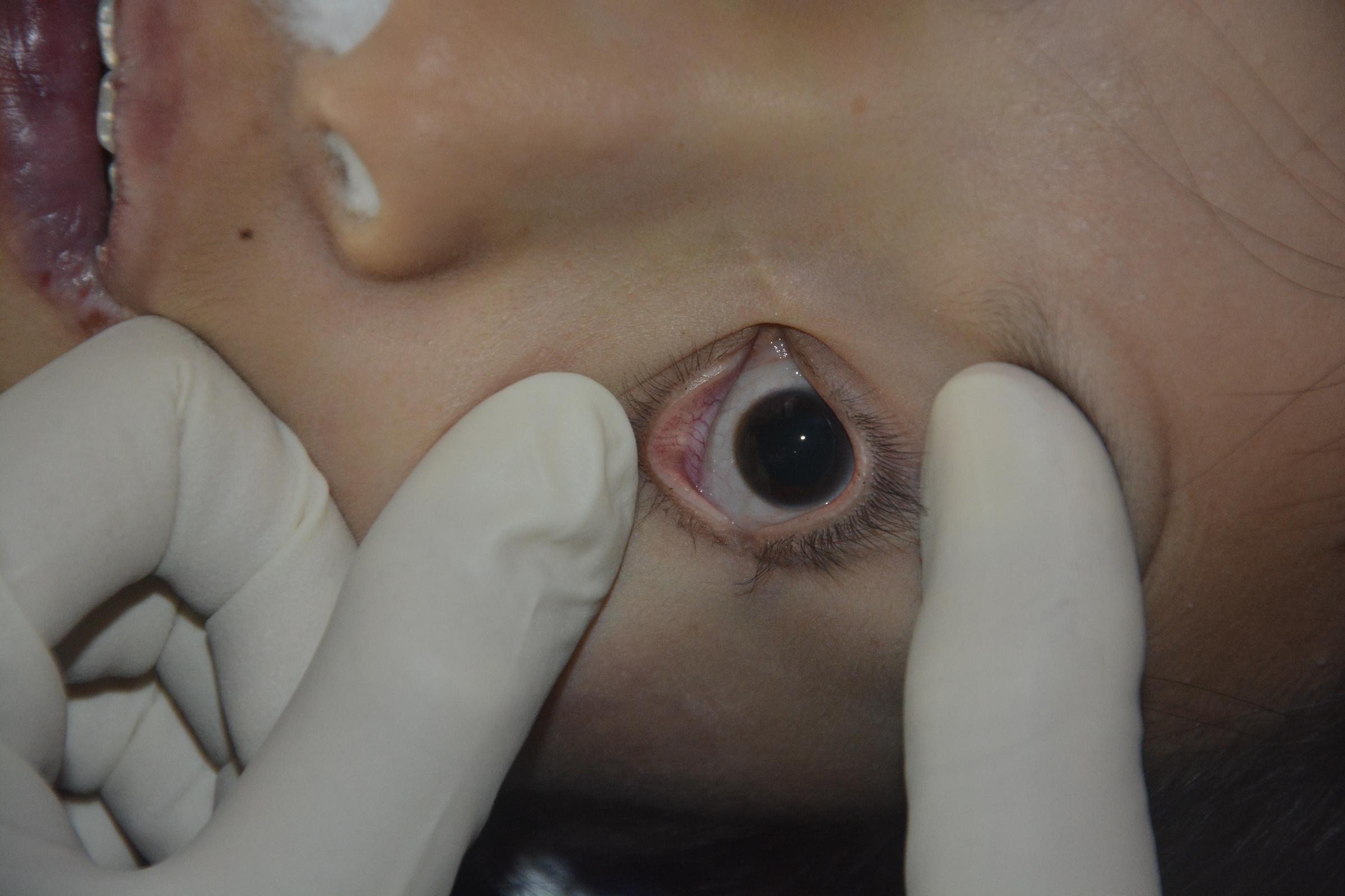 Pretty Chinese girl naked in morgue