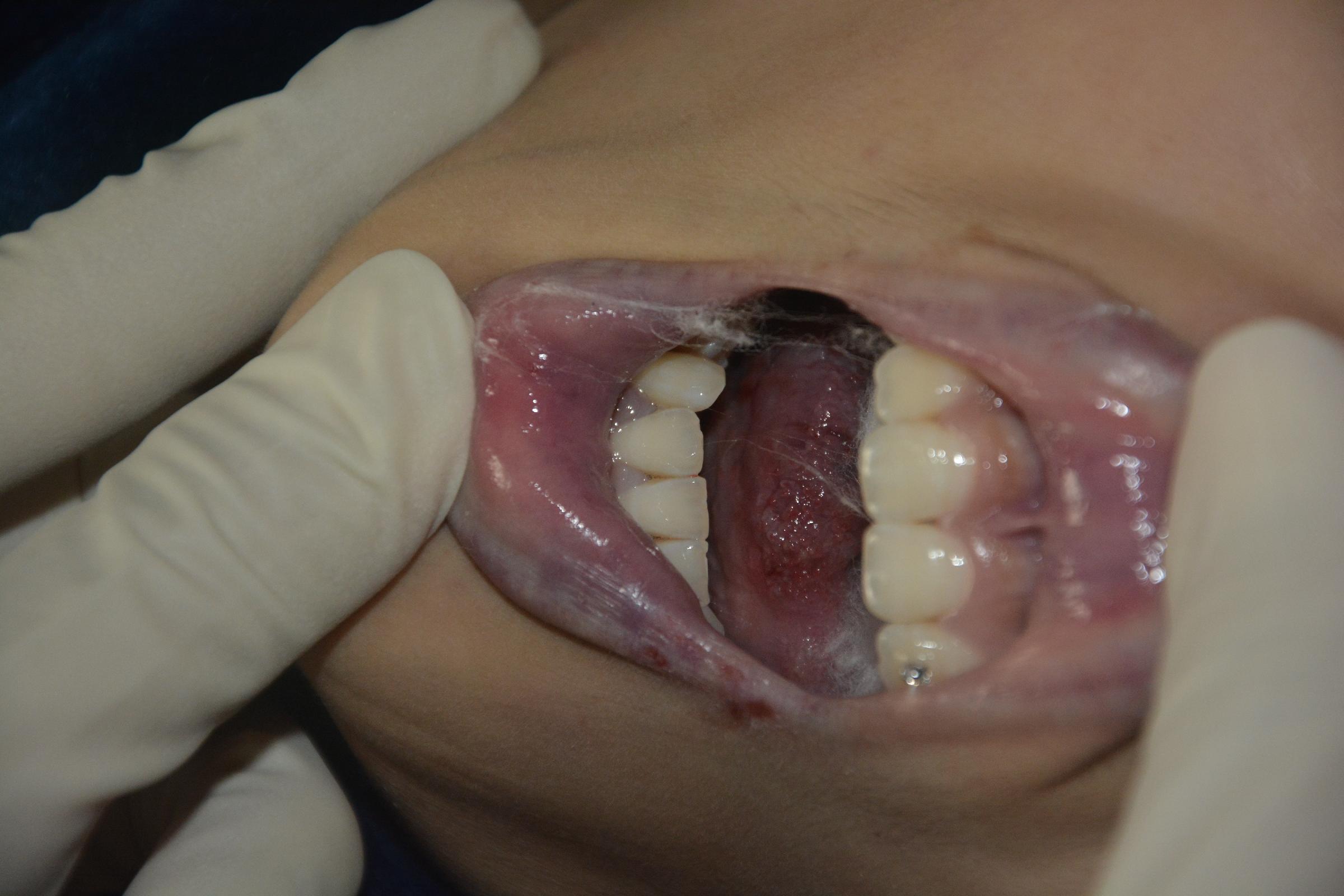 Pretty Chinese girl naked in morgue