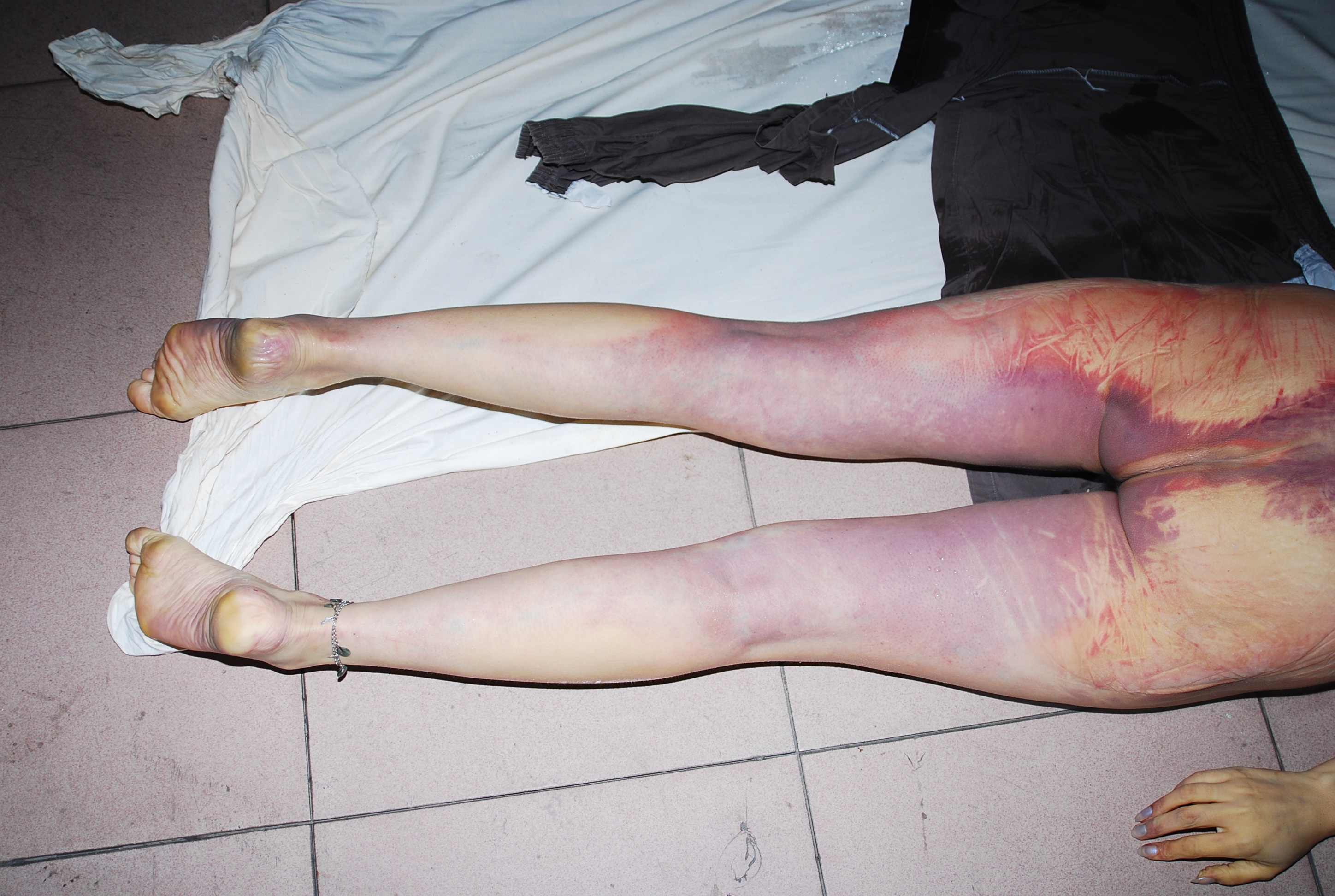 Chinese woman naked in morgue