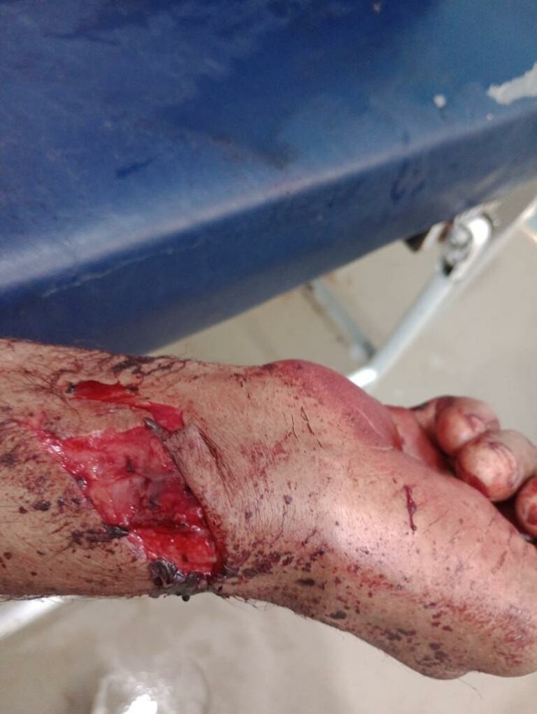 Murdered with several stab wounds to the body