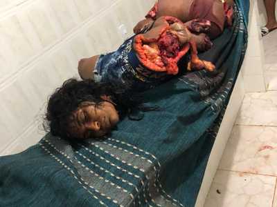 Beautiful Girl Chopped to Pieces (Perfect Body)