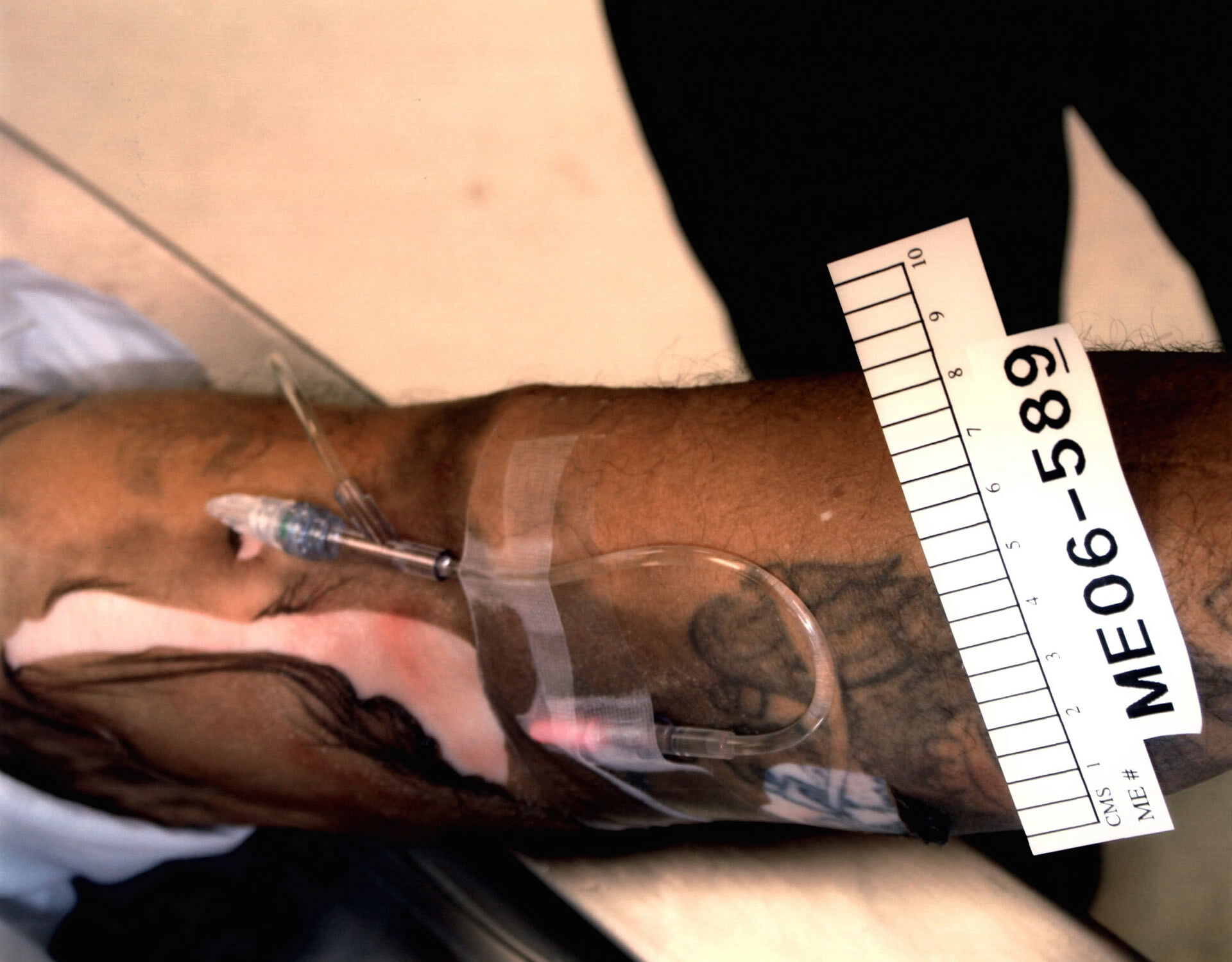 DAMN: Photos from a Botched Lethal Injection