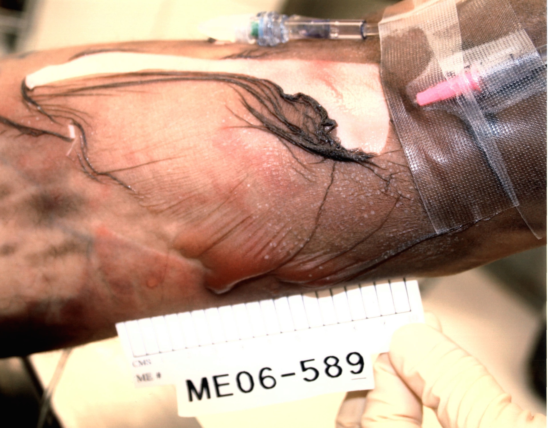 DAMN: Photos from a Botched Lethal Injection