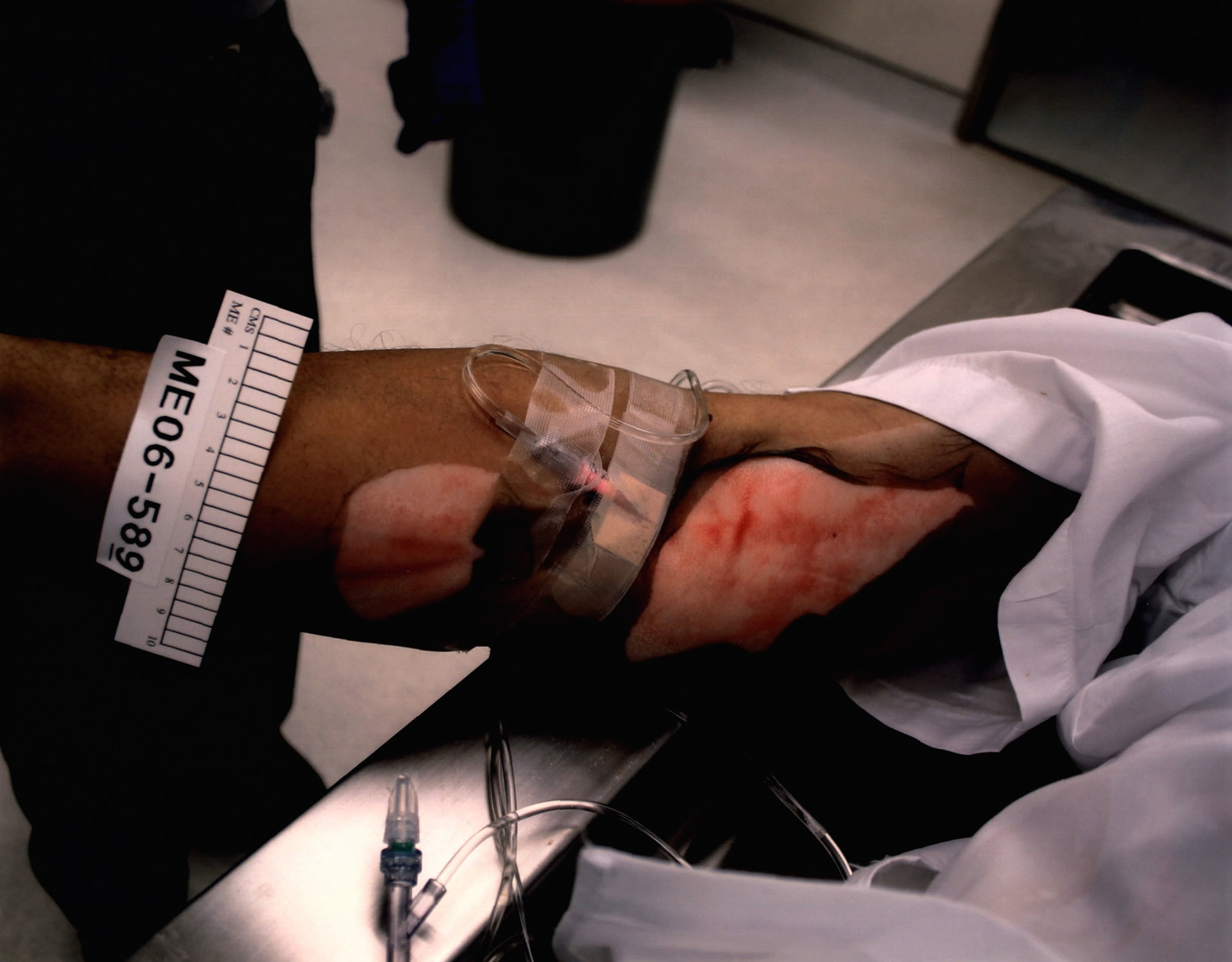 DAMN: Photos from a Botched Lethal Injection