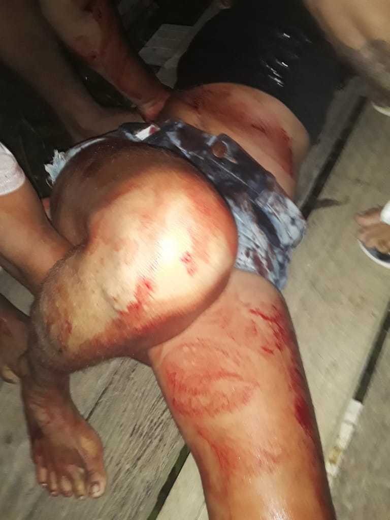 Pretty Woman Slashed and Stabbed to Death.