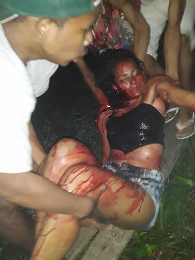 Pretty Woman Slashed and Stabbed to Death.