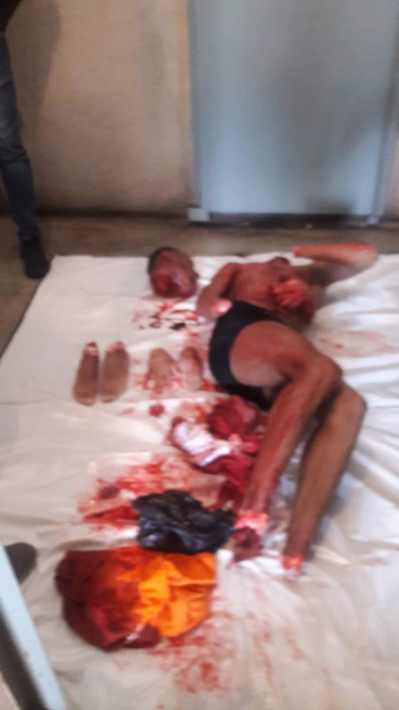 Dismembered Cellmate in Brazilian Prison