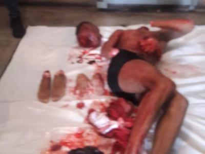 Dismembered Cellmate in Brazilian Prison