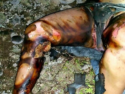 unfaithful wife burned by husband