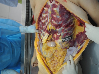 The Chinese prostitute serial killer new victim 