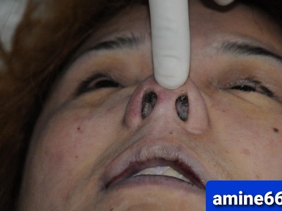 Chinese hooker strangled to death by client in hotel room