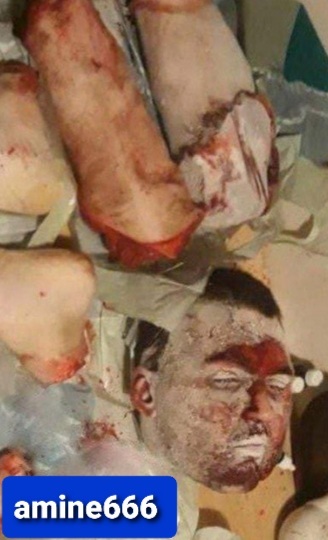 Ukrainian Rapper’s Wife Chopped up Dead Husband’s Corpse