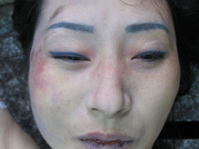 Examination of dead Chinese woman. 