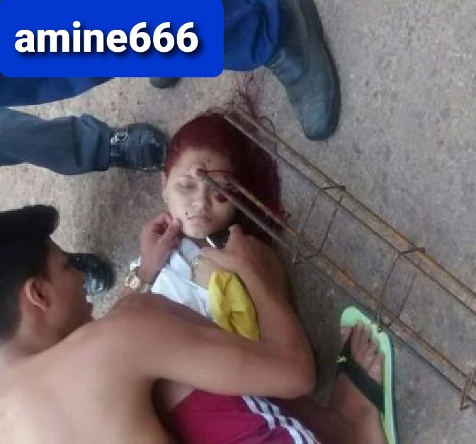 Young Lady Dies After Being Stuck in the Head with a Steel Beam