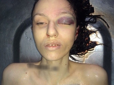 Depressed woman commit suicide by jumping 