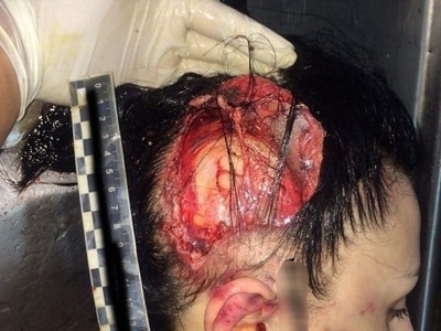 Depressed woman commit suicide by jumping 