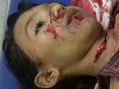 12 Year Old stabbed with broken Bottle