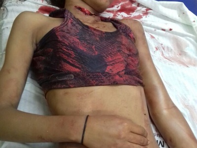 Girl Stabbed with Broken Bottle