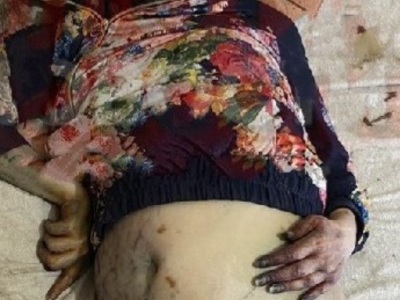 Old Woman Dies in Her Bed So Her Starving Dog Eats Her Face