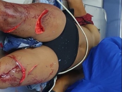 Angry husband overkill his wife using machete 