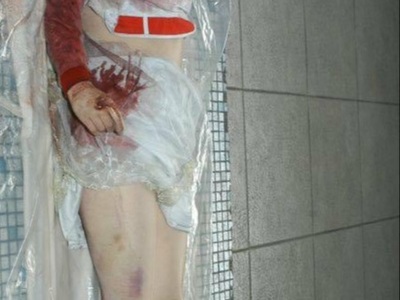 Asian woman falls from height, cracks her scull.