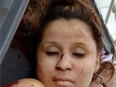 Girl Thrown Out of Moving Car Head Busted